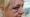 The woman's injuries after the attempted robbery in Lichfield