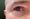 An eyeball