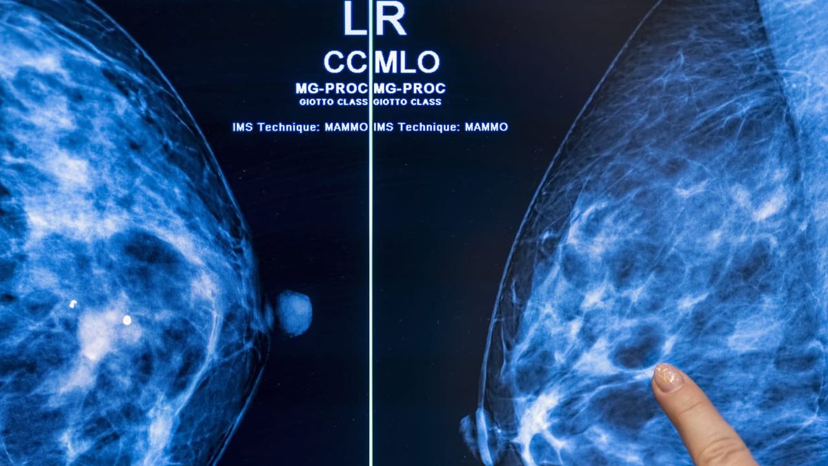Why young cancer patients need special help