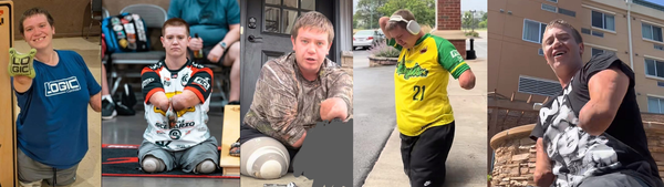 Quadruple amputee and cornhole champion charged with murder after fatally shooting a friend.