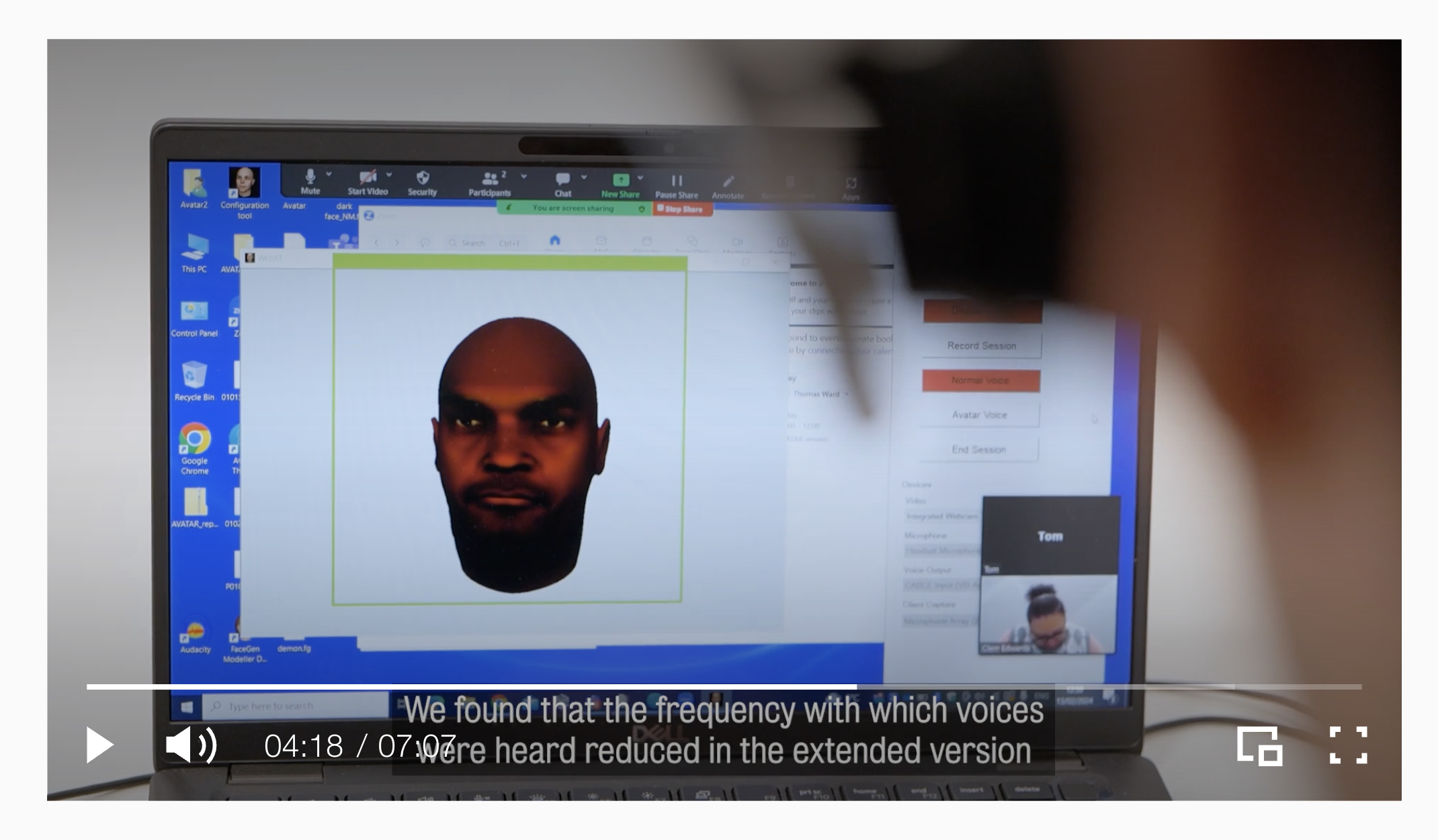 A screen grab from a video on AVATAR 2. Shows an avatar on a computer screen with an inset image of the patient. The caption reads: "We found that the frequency with which voices were heard reduced in the extended version."