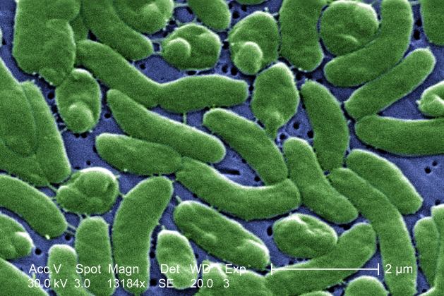 Deadly Vibrio cases rise along Gulf Coast. Here's what Tampa Bay residents should know before entering the water.