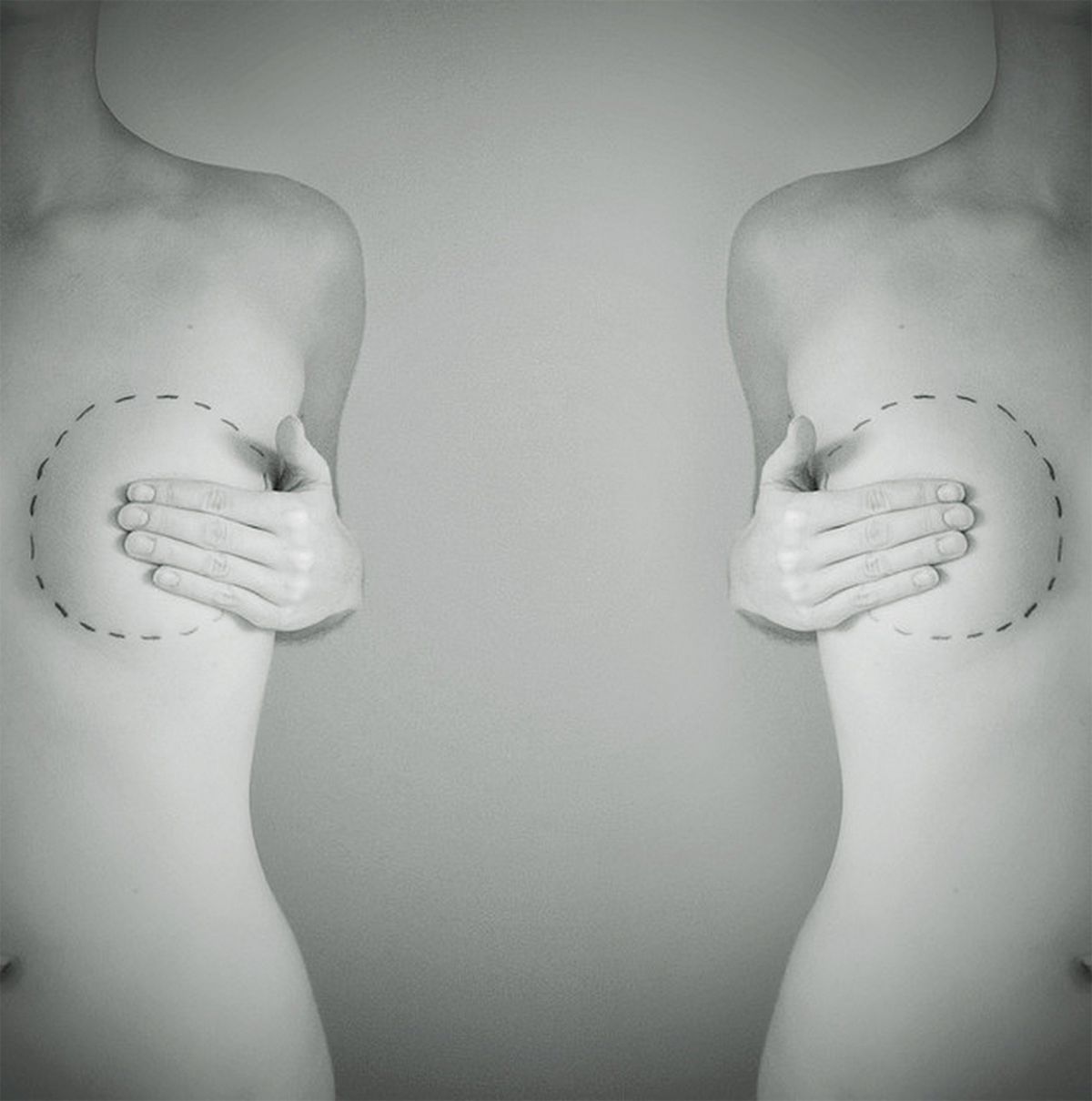 Replacing Things Lost