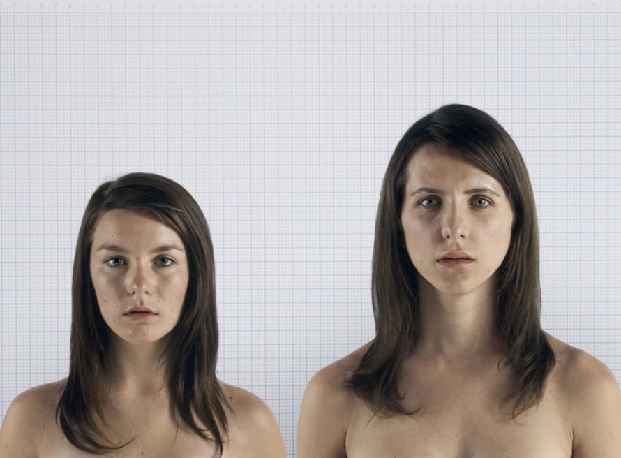 Teen and Transgender Comparative Study