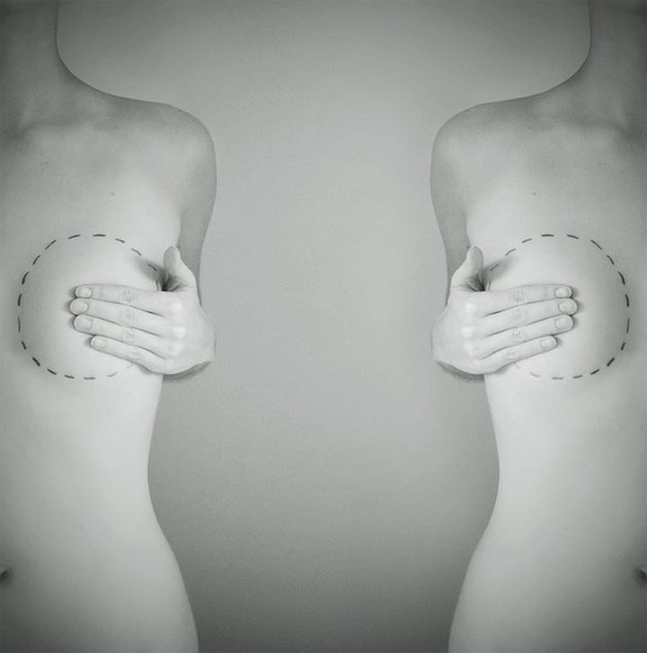 Replacing Things Lost