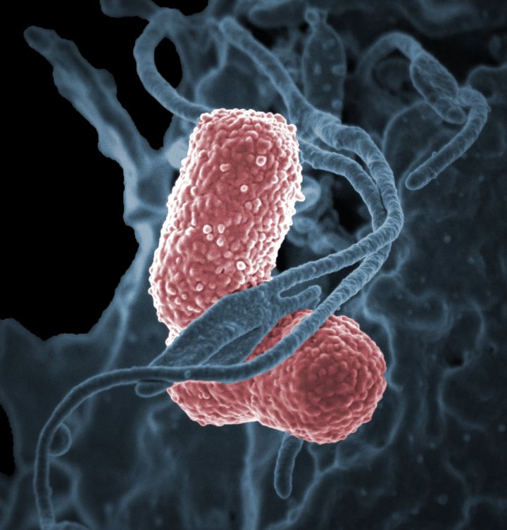 The superbugs are here