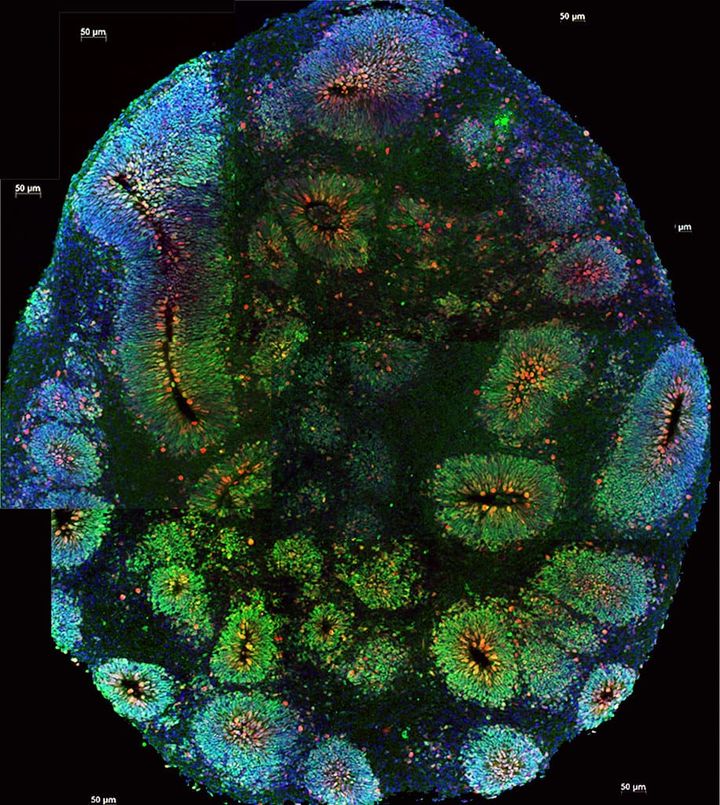 "Brain Organoid" by National Institutes of Health (NIH) is licensed under CC BY-NC 2.0. To view a copy of this license, visit https://creativecommons.org/licenses/by-nc/2.0/.