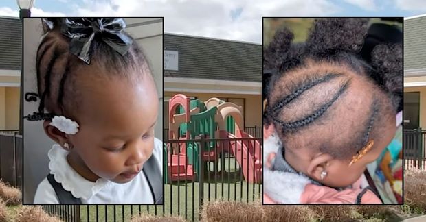 Mom Upset That Daughter’s Braid Went Missing at Daycare, Suspects Foul Play