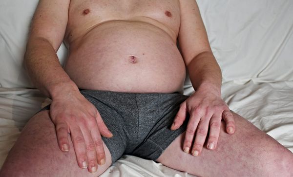 The Dick Diaries: MS