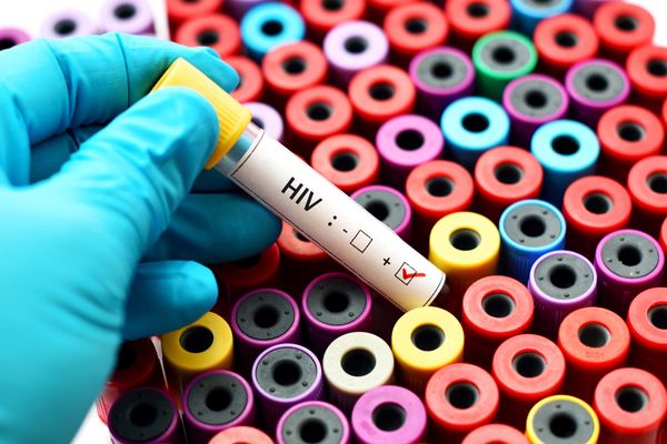 Fiji grapples with surge in HIV