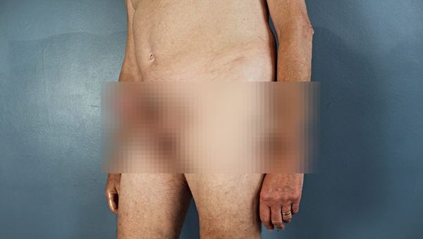 The Dick Diaries: Woody