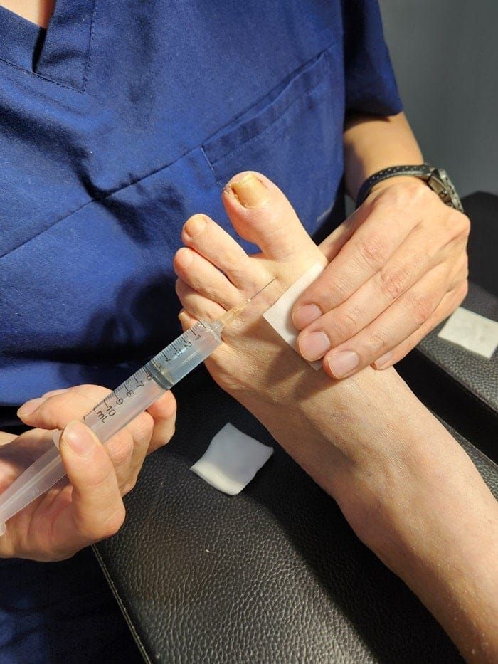 Ingrown Toenail Pain, Inflammation & Discharge — Big Toe Treatment in Gangnam