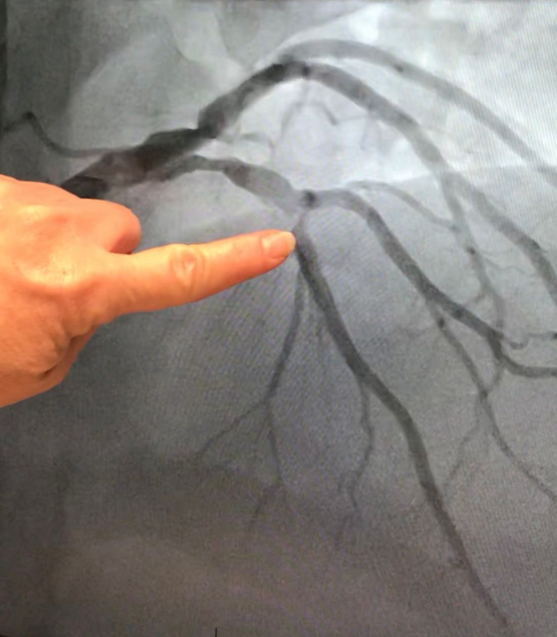 Attending to the Heart