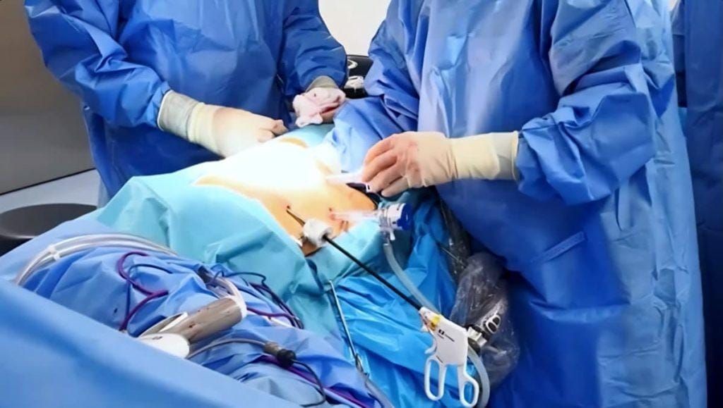 MINSA y CSS buscan médicos especialistas, ¿nacionales o de afuera?