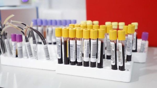 Bancos de sangre CSS abrirán en carnavales 2026