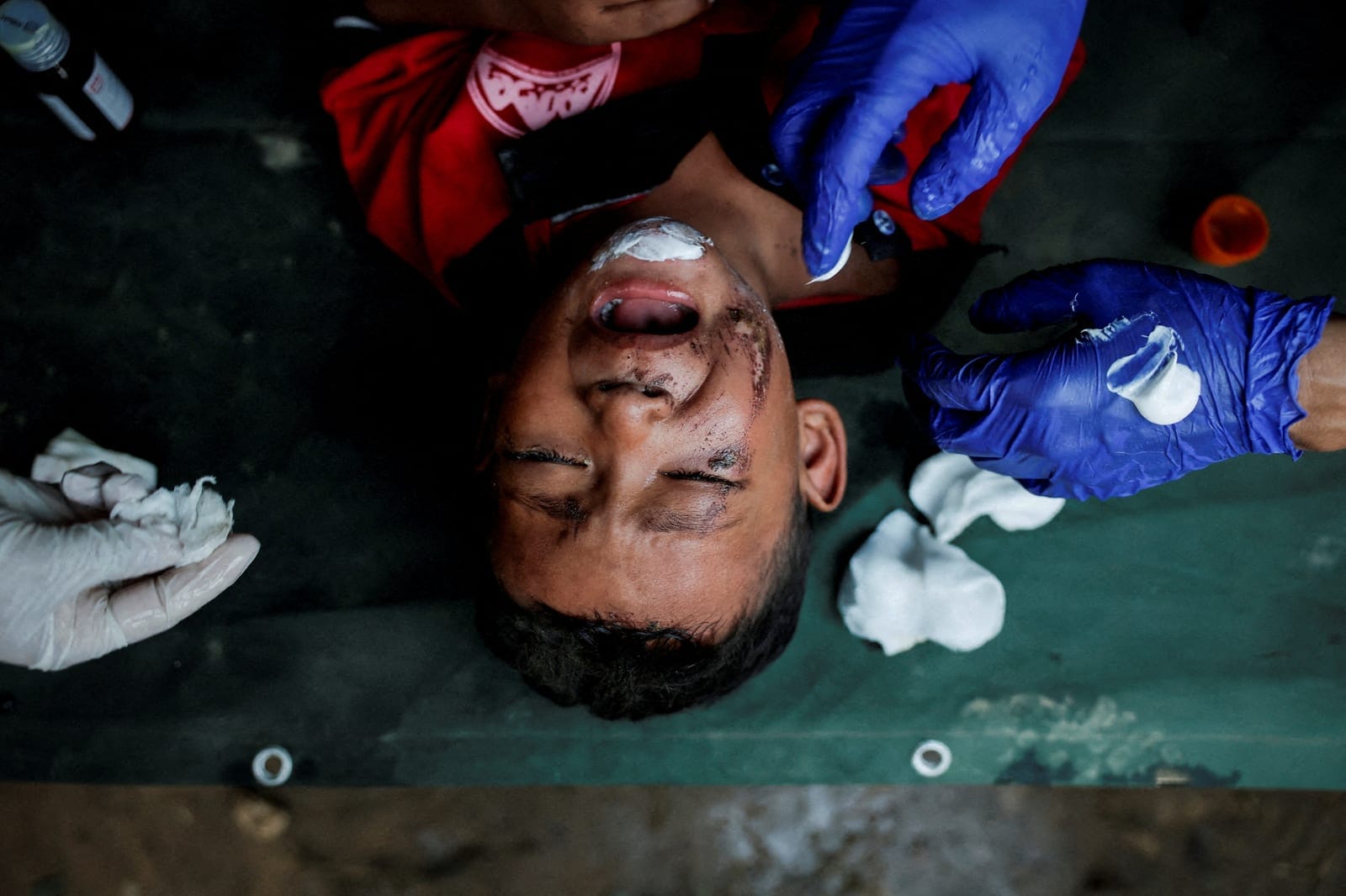 A child, who was airlifted from Rasuwa district, receives first-aid at a mobile hospital inside the Maithili Barrack, an army training centre, which also serves as a primary base to airlift survivors following flash floods and mudslide at Trishuli in