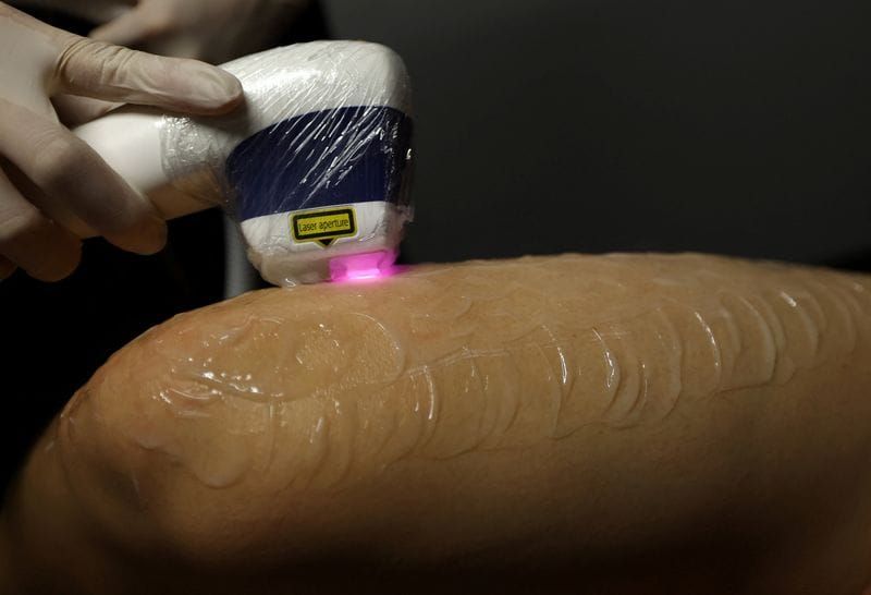 Japanese Men Are Booking Out Hair Removal Clinics to Survive Record Summer Heat post image