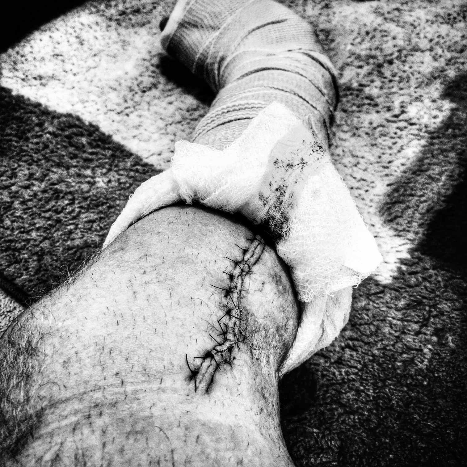 The Scar Tissue Behind Live Inspired