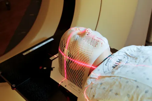 AI to spot cancer? Amid workforce burnout, testing novel algorithms is urgent says Royal Marsden