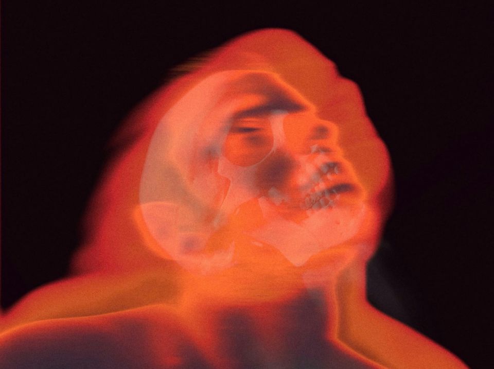 AWS Outage: It’s always DNS, but… sometimes it’s overloaded network hardware