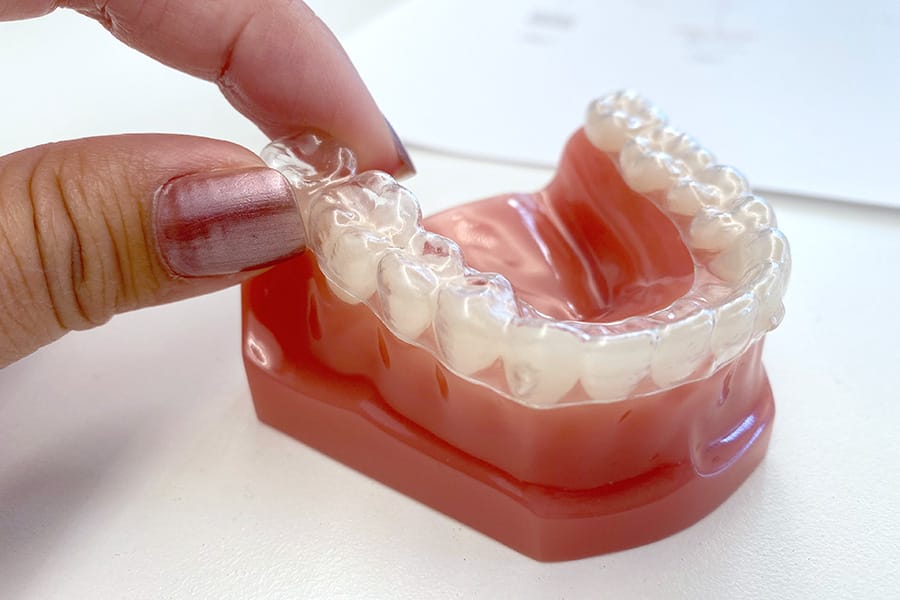 Braces Alternative Clear Aligners with Uniform Teeth San Francisco model