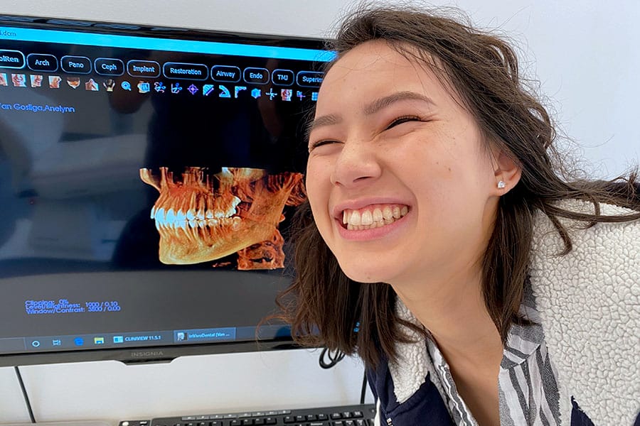 Braces Alternative Clear Aligners with Uniform Teeth San Francisco 3d x-ray