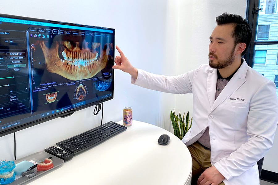 Braces Alternative Clear Aligners with Uniform Teeth San Francisco dr yoo