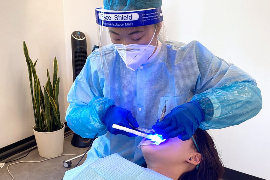 Uniform Teeth Clear Aligner Teeth Straightening Alignment Phase - Adding anchors