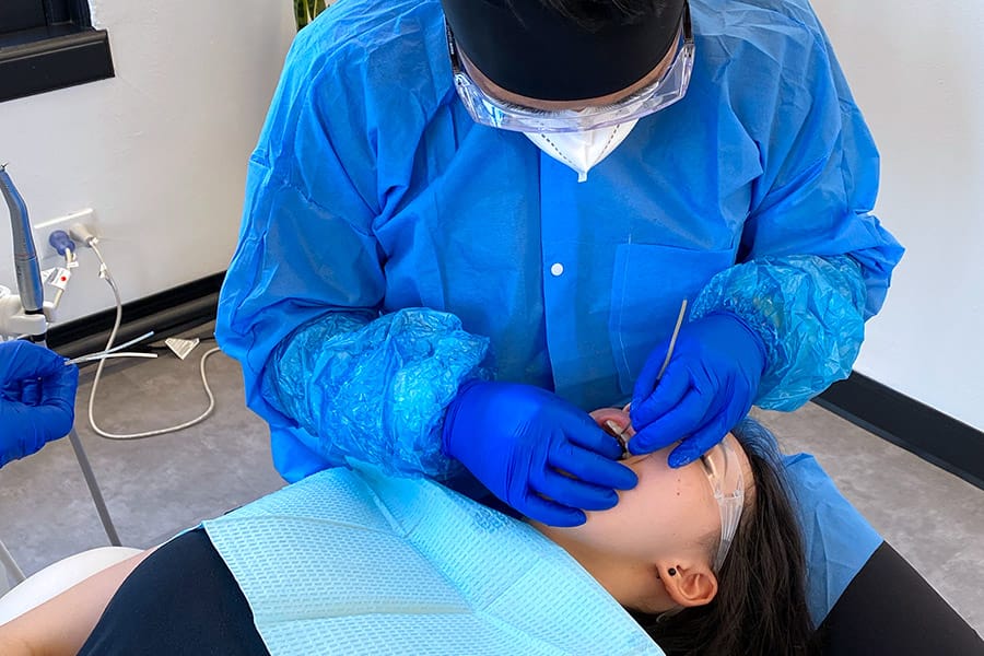 Uniform Teeth Clear Aligner Teeth Straightening Alignment Phase - Metal filing to make space / room