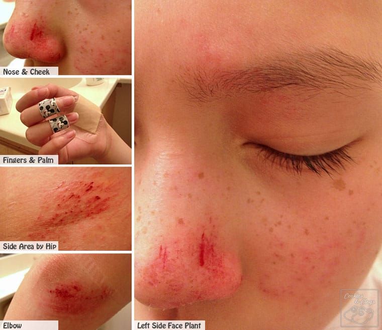 Bicycle Fail / Fall Face Plant