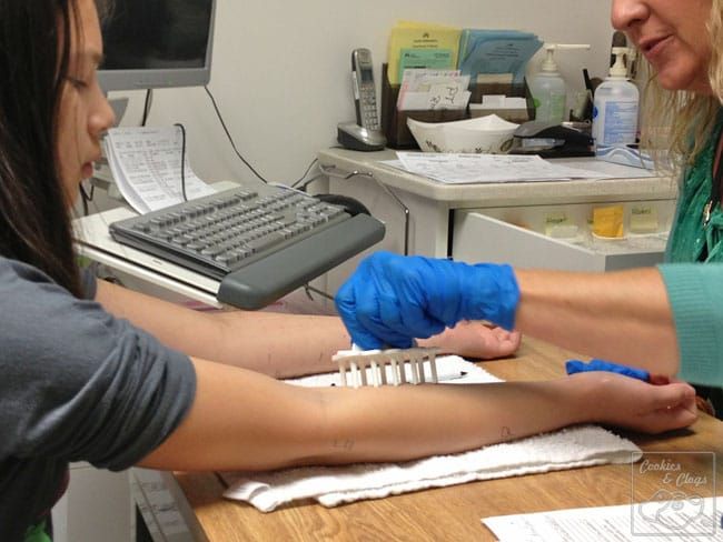 Allergy Testing on the Arm