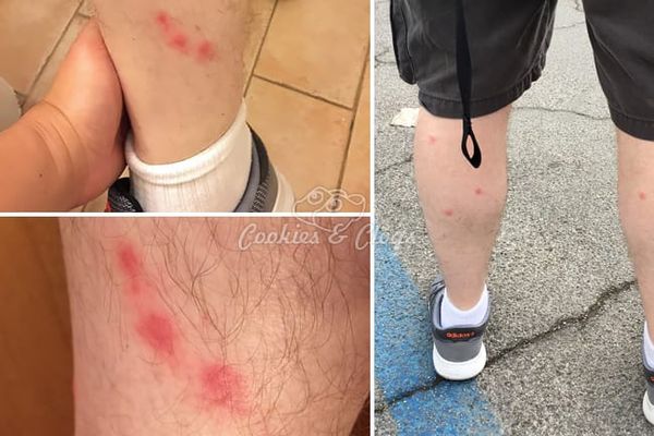 Travel | Italy | Our dream family vacation turned into a nightmare travel story with bed bugs and more. See how lodging place