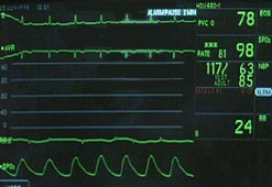 The Build Server: Your Project’s Heart Monitor