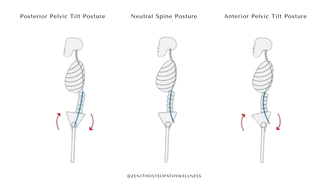 Visual showing anterior and posterior pelvic tilt postures