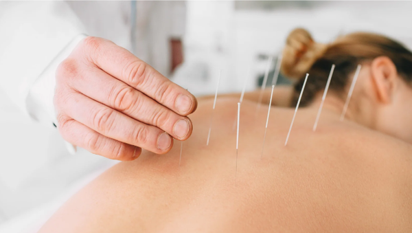 Akupunktur bei CED - eine ergänzende Therapiemöglichkeit