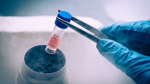 Mesenchymale Stammzellen-Therapie bei CED: Eine neue Hoffnung?
