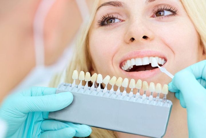 Whole Tooth Column: 3 things most people get wrong about veneers