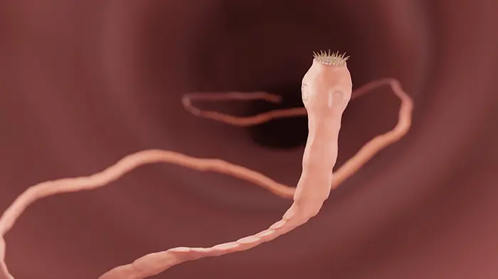 Tapeworm