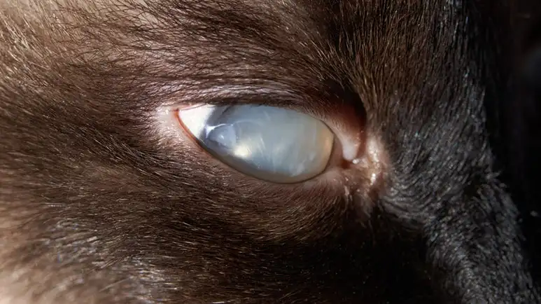 When Cloudy Eye Could Mean More Than Aging
