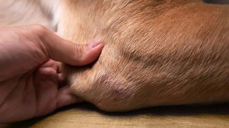 legg calve perthes disease