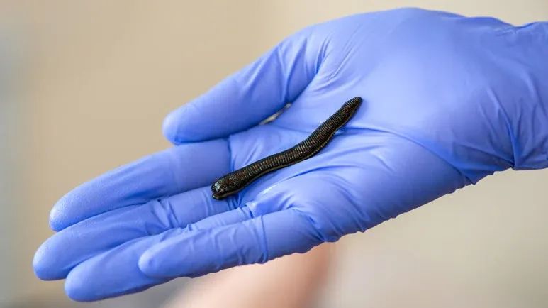 medicinal leech therapy