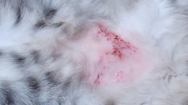 fecal transplant atopic dermatitis