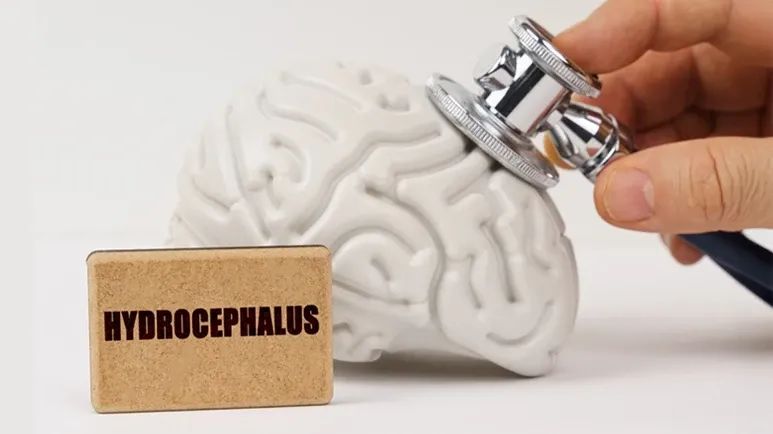 hydrocephalus pets