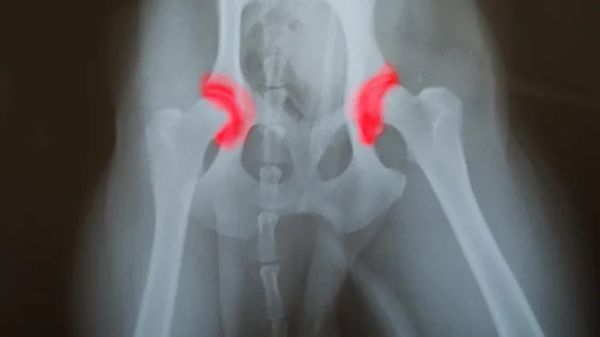 canine hip dysplasia