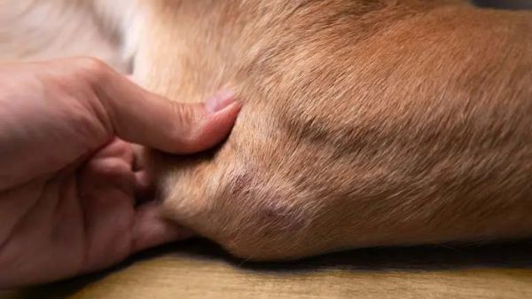 legg calve perthes disease