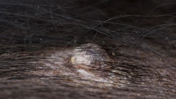 mast cell tumors in pets