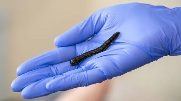 medicinal leech therapy