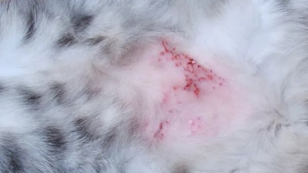 fecal transplant atopic dermatitis