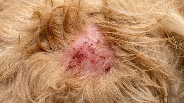 what triggers hot spots