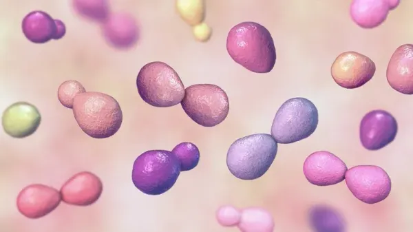 histoplasmosis in pets
